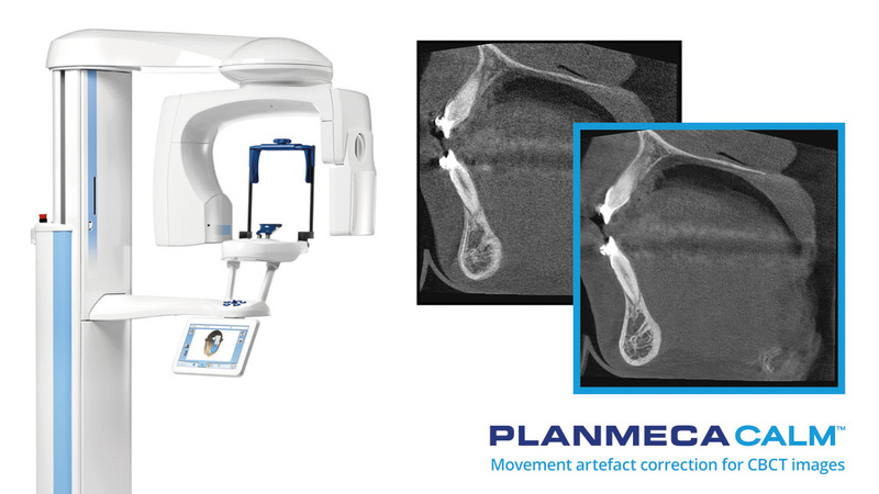 Dòng máy CBCT PLANMECA dẫn đầu thế giới về chất lượng hình ảnh và an toàn cho bệnh nhân.
